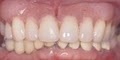 Hawaii Pacific Dental Group - Dr. Rohinton J. Patel image 7