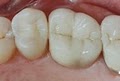 Marina Tooth Fairy: Dr. Hibret Hailu Benjamin image 9