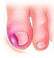 Midtown NY Podiatrist - Dr. Isaac Tabari, DPM image 4