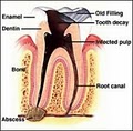 Rishwain, Darron DDS-Marin Endodontics*Root Canals*Endodontists*Root Canal Marin image 2