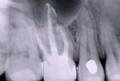Rishwain, Darron DDS-Marin Endodontics*Root Canals*Endodontists*Root Canal Marin image 5