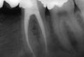 Rishwain, Darron DDS-Marin Endodontics*Root Canals*Endodontists*Root Canal Marin image 7