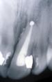 Rishwain, Darron DDS-Marin Endodontics*Root Canals*Endodontists*Root Canal Marin image 9