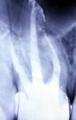 Rishwain, Darron DDS-Marin Endodontics*Root Canals*Endodontists*Root Canal Marin image 10