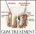 Summit Dental-Dentist Oakland-Emergency Dentist*Zoom Implant Dentist*Crowns*TMJ image 5