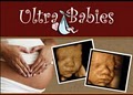 Ultra Babies 3D 4D Ultrasound logo