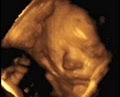 A Little Insight 3D 4D Ultrasound image 2