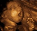 A Little Insight 3D 4D Ultrasound image 1