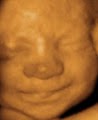 Baby Image 3D-4D Ultrasound image 2