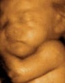 Baby Image 3D-4D Ultrasound image 3