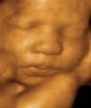 Baby Image 3D-4D Ultrasound logo