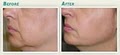 Cosmetic Dermatology & Laser Center image 4