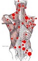 Mary Jo Smiley Certified Myofascial Trigger Point Therapist, Medical MT, NMT image 8