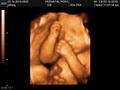 Prenatal Peek 3D Ultrasonund logo