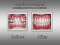 1st Impressions Orthodontics image 2