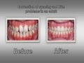 1st Impressions Orthodontics image 1