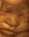 Baby's Debut 3D/4D Ultrasound LLC image 2
