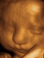Baby's Debut 3D/4D Ultrasound LLC image 3