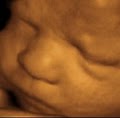 Baby's Debut 3D/4D Ultrasound LLC logo