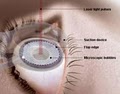 Blum Lasik & Eye Care Center image 4