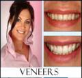 P Rosenbaum DDS-Emergency Dental-Zoom-Invisalign-Veneers-Crowns-Sedation Dentist image 2