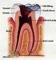 P Rosenbaum DDS-Emergency Dental-Zoom-Invisalign-Veneers-Crowns-Sedation Dentist image 6
