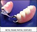 P Rosenbaum DDS-Emergency Dental-Zoom-Invisalign-Veneers-Crowns-Sedation Dentist image 7