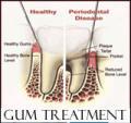 P Rosenbaum DDS-Emergency Dental-Zoom-Invisalign-Veneers-Crowns-Sedation Dentist image 8
