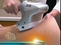Texas Inst Dermatology: Dermatology and Skin Care Clinic image 5