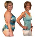 Weight Loss Lutz Pure Health Studios image 1