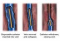ALUNA, RAMTIN MASSOUDI, M.D., COSMETIC AND LASER MEDICINE AND LASER VEIN SURGERY image 5