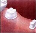 AVON FIRSTdental,LLC image 4