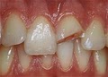 AVON FIRSTdental,LLC image 5