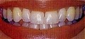 AVON FIRSTdental,LLC image 6
