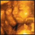 Baby Envision image 1