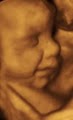 Bellyssimo 4D Prenatal Imaging image 2
