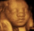 Bellyssimo 4D Prenatal Imaging image 3