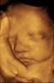 Bellyssimo 4D Prenatal Imaging logo