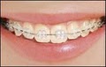 Burbey Orthodontics image 10