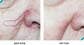 Cosmetic Laser & Skin Rejuvenation Clinic image 4