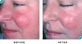 Cosmetic Laser & Skin Rejuvenation Clinic image 5