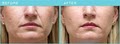Cosmetic Laser & Skin Rejuvenation Clinic image 6