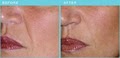 Cosmetic Laser & Skin Rejuvenation Clinic image 7