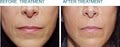Cosmetic Laser & Skin Rejuvenation Clinic image 9