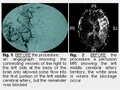Division of Interventional Neuroradiology image 5