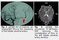 Division of Interventional Neuroradiology image 6