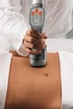 Esteem Medspa Laser Hair Removal image 6