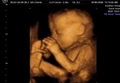 GoldenView Ultrasound 3D and 4D image 2