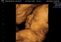 GoldenView Ultrasound 3D and 4D image 3