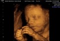 GoldenView Ultrasound 3D and 4D image 4